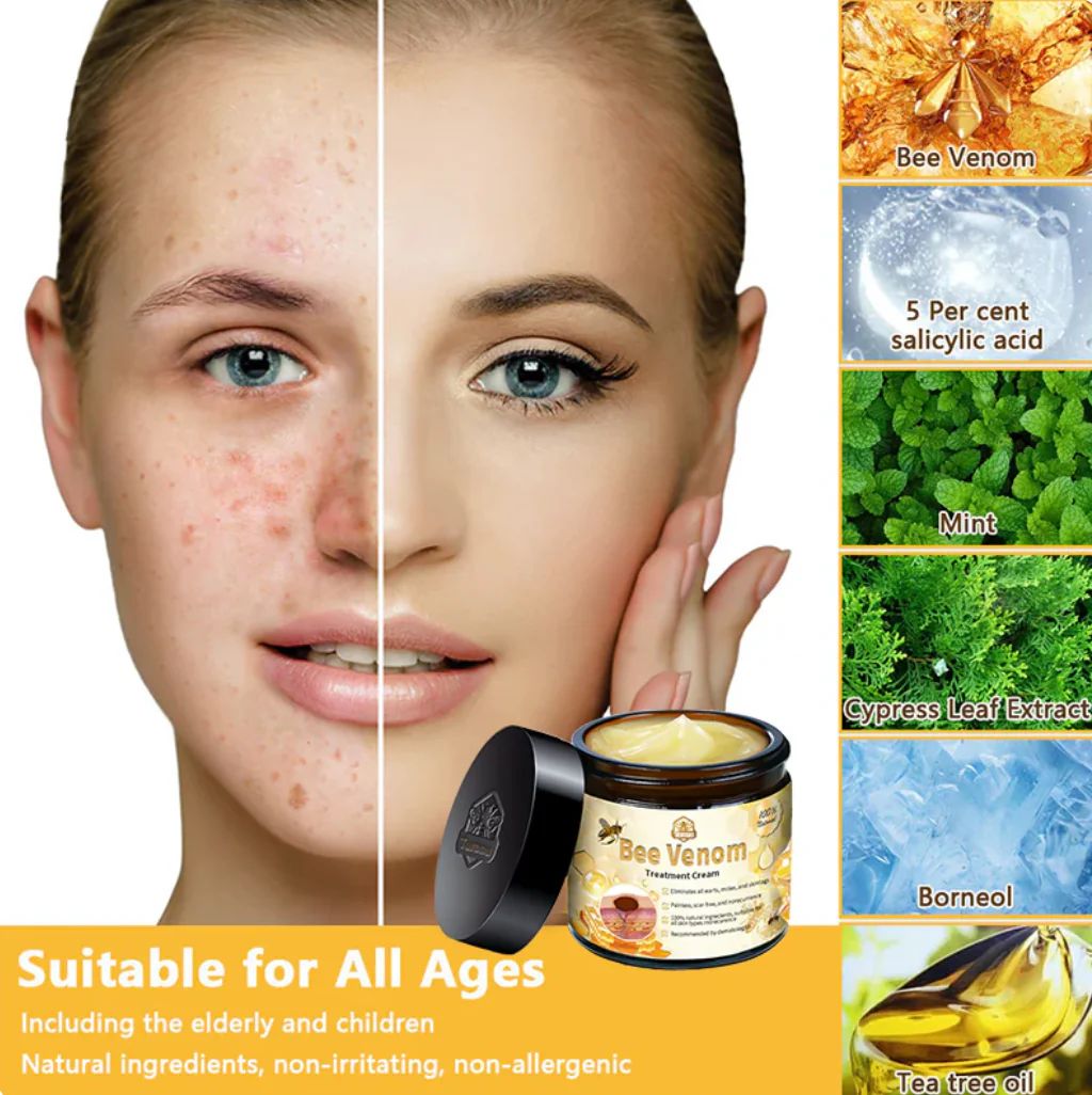 Bee Skin Elixir – Natural Bee Venom & Herbal Acne Cream for Clear Skin, (60g